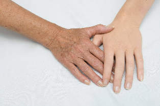 pomlađivanje kože ruku